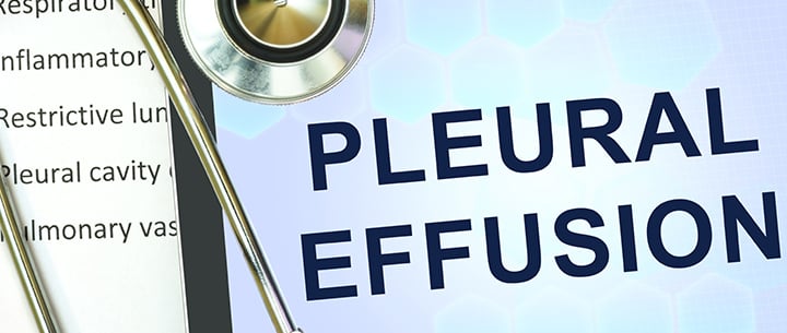 Pleural effusion written on tablet