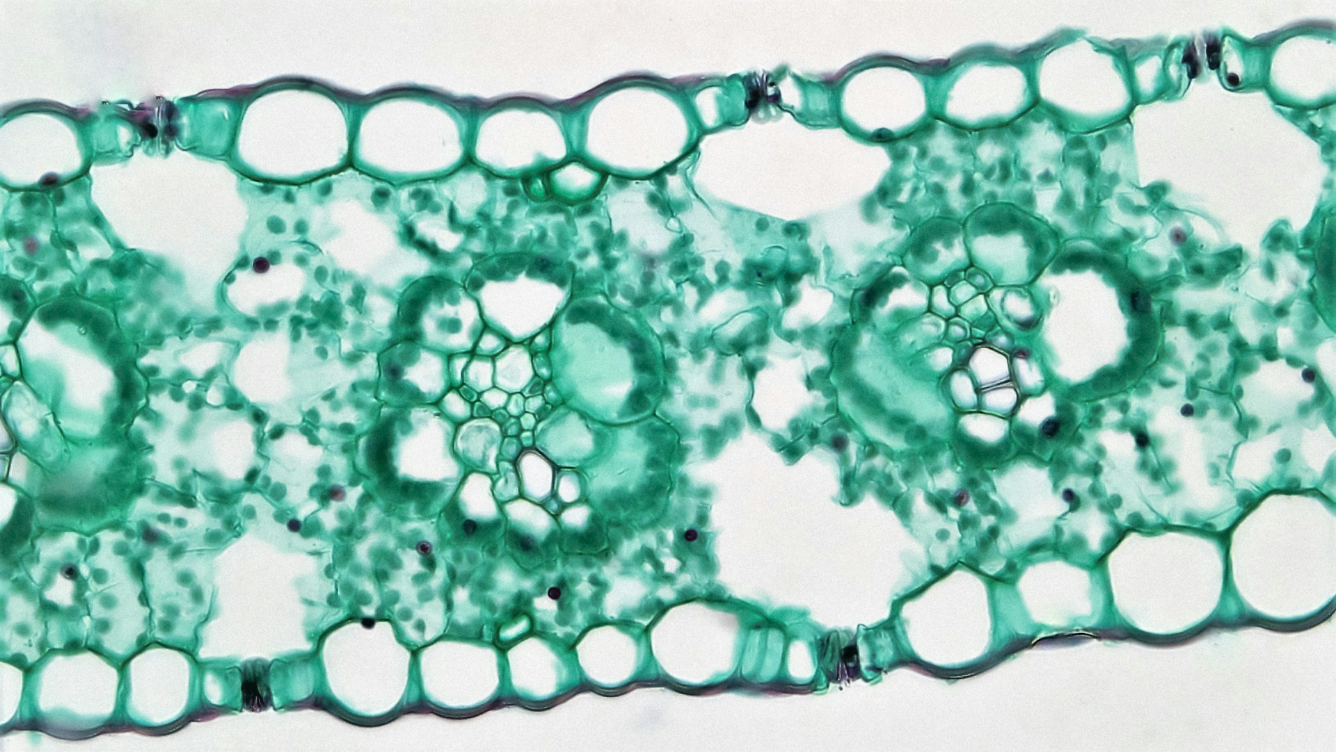 Microscopic view of biphasic mesothelioma tissue showing a combination of epithelioid and sarcomatoid cell structures.